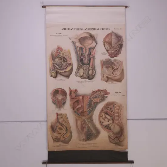 LG VINTAGE CANVAS BACKED US FROHSE ANATOMICAL CHART BY A.J. NYSTROM & CO. 1200 X 1820MM