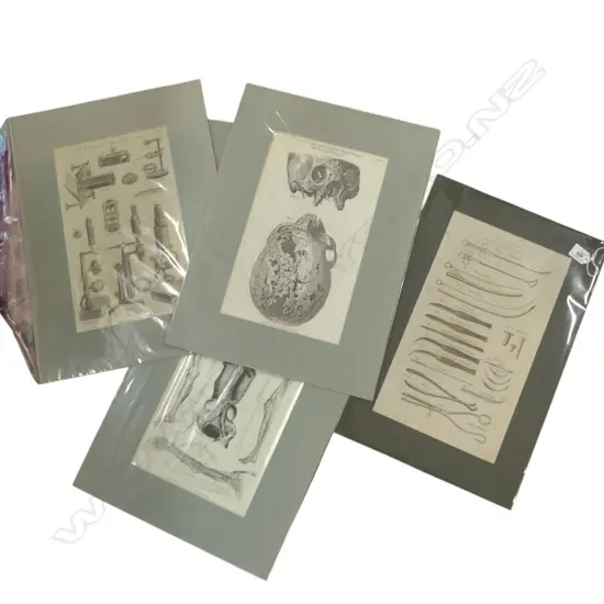 6 ANTIQUE ENGRAVINGS; MEDICAL THEMES 375x215mm 