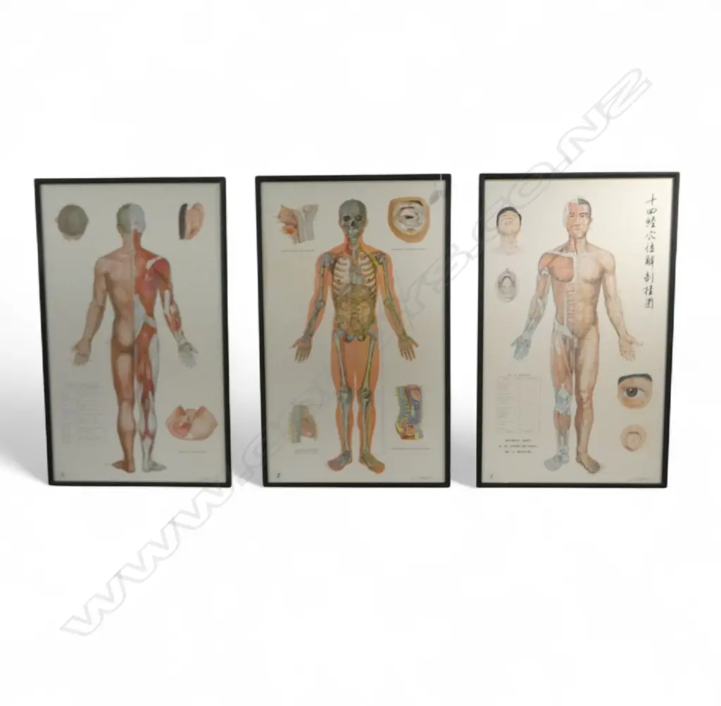 3 FRAMED ACCUPUNCTURE POSTERS (NO GLASS) 1040x620mm Image 1++